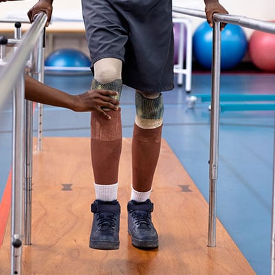PROSTHETIC LEGS